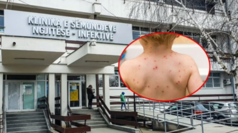 Fruthi po shpërndahet tek fëmijët, regjistrohen 10 raste – mjekët: Mos bini pre e dezinformatave, vaksinoni fëmijët