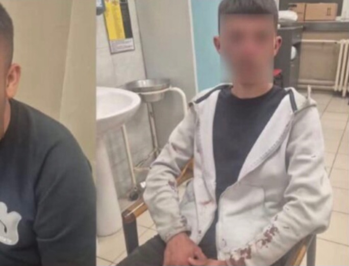 MPB ja suspendon nga puna 6 policë për dhunën ndaj dy të rinjve në Saraj