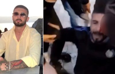 U plagos me plumb gome në sy gjatë protestës/ 28-vjeçari Erjon Vishkulli dyshohet se ka humbur shikimin në syrin e majtë